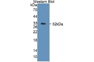 Western blot analysis of the recombinant protein. (TOP3B Antikörper  (AA 1-250))