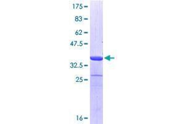 STIP1 Protein (AA 445-543) (GST tag)