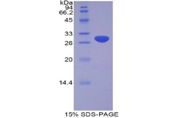 ADAM20 Protein