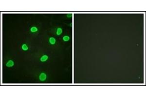 Immunofluorescence analysis of HeLa cells, using Histone H4 (Acetyl-Lys5) Antibody. (Histone H4 Antikörper  (acLys5))