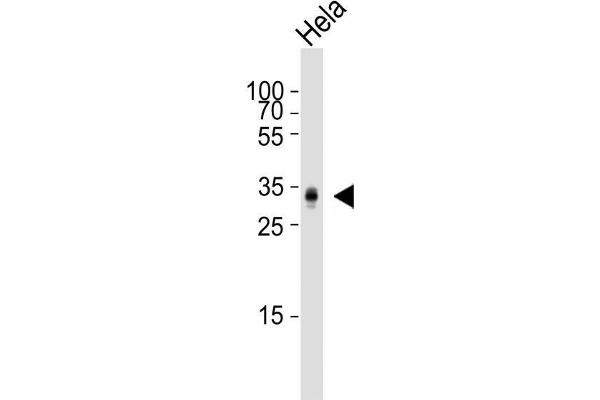 PPT1 Antikörper