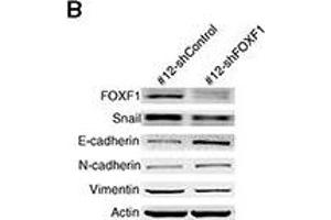 Western Blotting (WB) image for anti-Vimentin (VIM) antibody (ABIN2854814)