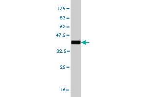 Western Blotting (WB) image for anti-EPM2A (Laforin) Interacting Protein 1 (EPM2AIP1) (AA 508-606) antibody (ABIN564241)