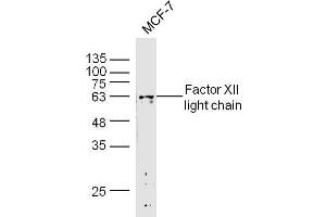 MCF-7 lysates probed with Factor I heavy chain Polyclonal Antibody, Unconjugated  at 1:300 dilution and 4˚C overnight incubation. (Factor I Heavy Chain (AA 261-360) Antikörper)