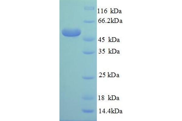 RPL14 Protein (AA 2-214, partial) (GST tag)