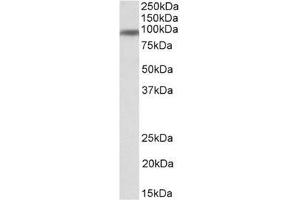 Staining of Human Breast lysate using CD71 / TFRC Antibody at 1 µg/ml (35µg protein in RIPA buffer). (Transferrin Receptor Antikörper  (N-Term))