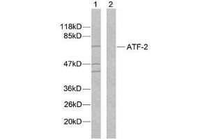 Western blot analysis of extracts from MDA-MB-435 cells using ATF-2 (Ab-112 or 94) antibody (E021033). (ATF2 Antikörper)