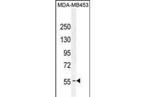 ESR1 antibody (ABIN659085 and ABIN2838074) western blot analysis in MDA-M cell line lysates (35 μg/lane). (Estrogen Receptor alpha Antikörper)