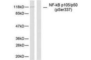 Western Blotting (WB) image for anti-Nuclear Factor of kappa Light Polypeptide Gene Enhancer in B-Cells 1 (NFKB1) (pSer337) antibody (ABIN2888484) (NFKB1 Antikörper  (pSer337))