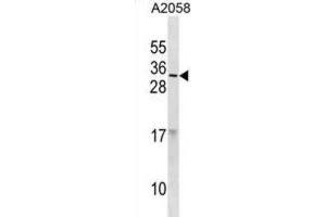 Western Blotting (WB) image for anti-Ribonuclease, RNase A Family, 9 (Non-Active) (RNASE9) antibody (ABIN3001184) (RNASE9 Antikörper)