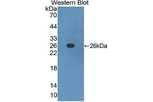 Western Blotting (WB) image for anti-Interferon alpha/beta Receptor 1 (IFNAR1) (AA 28-227) antibody (ABIN2118487) (IFNAR1 Antikörper  (AA 28-227))