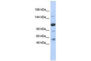 Image no. 1 for anti-U2-Associated SR140 Protein (SR140) (AA 71-120) antibody (ABIN6740719) (SR140 Antikörper  (AA 71-120))