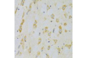 Immunohistochemistry of paraffin-embedded rat brain using CASP9 Antibody (ABIN5971434) at dilution of 1/100 (40x lens). (Caspase 9 Antikörper)