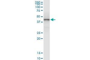 Immunoprecipitation of HLA-A transfected lysate using rabbit polyclonal anti-HLA-A and Protein A Magnetic Bead (HLA-A (Human) IP-WB Antibody Pair)