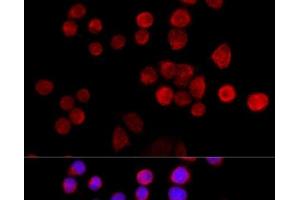 Immunofluorescence analysis of 293T cells using SLC25A17 Polyclonal Antibody at dilution of 1:100 (40x lens). (SLC25A17 Antikörper)