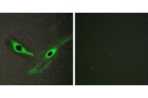 Peptide - +Immunohistochemistry analysis of paraffin-embedded human brain tissue, using ICK antibody. (ICK Antikörper)