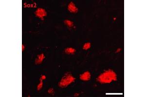 Sox2 antibody (pAb) tested by Immunofluorescence. (SOX2 Antikörper  (C-Term))