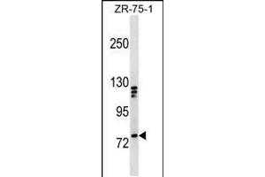 Western blot analysis in ZR-75-1 cell line lysates (35ug/lane). (KIF3A Antikörper  (C-Term))