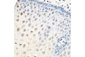 Immunohistochemistry of paraffin-embedded human esophagus using HNRNPA0 antibody. (HNRNPA0 Antikörper  (AA 1-180))