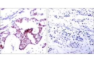 Immunohistochemistry (IHC) image for anti-Nuclear Factor-kB p65 (NFkBP65) (pSer276) antibody (ABIN2888487) (NF-kB p65 Antikörper  (pSer276))