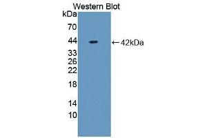 Detection of Recombinant NFkB, Rat using Polyclonal Antibody to Nuclear Factor Kappa B (NFkB) (NFkB Antikörper  (AA 352-439))