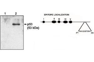 Image no. 1 for anti-Tumor Protein P53 (TP53) (AA 371-380) antibody (ABIN201677) (p53 Antikörper  (AA 371-380))