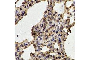 Immunohistochemical analysis of CDK6 staining in rat lung  formalin fixed paraffin embedded tissue section. (CDK6 Antikörper)