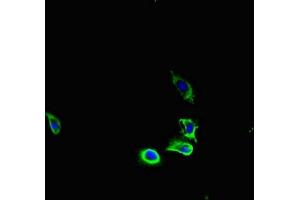Immunofluorescent analysis of U251 cells using ABIN7163626 at dilution of 1:100 and Alexa Fluor 488-congugated AffiniPure Goat Anti-Rabbit IgG(H+L) (PDGFRA Antikörper  (AA 30-198))