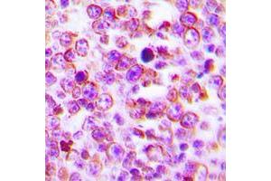 Immunohistochemical analysis of Claudin 2 staining in human tonsil formalin fixed paraffin embedded tissue section. (Claudin 2 Antikörper  (C-Term))