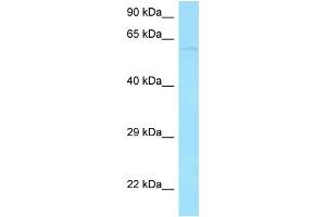 Western Blotting (WB) image for anti-Protein Phosphatase 2A 48 KDa Regulatory Subunit (PPP2R3B) (N-Term) antibody (ABIN2775378) (PPP2R3B Antikörper  (N-Term))