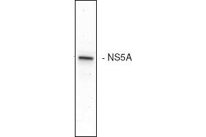 Western blot analysis of the HCV NS5A expression in Huh7 cells (Hepatitis C Virus Antikörper)