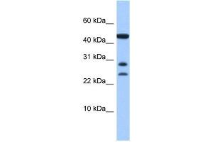 C20ORF141 antibody used at 1 ug/ml to detect target protein. (C20orf141 Antikörper  (Middle Region))