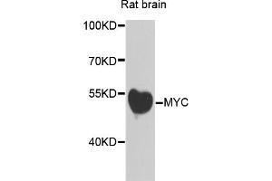 Western blot analysis of extracts of rat brain, using MYC antibody (ABIN5996012) at 1/500 dilution. (c-MYC Antikörper)