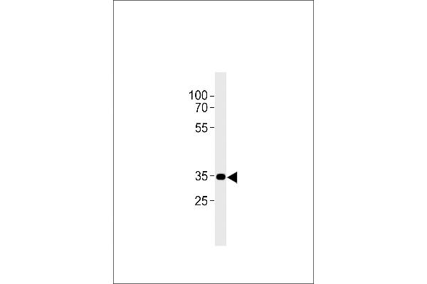 CNR2 Antikörper  (C-Term)