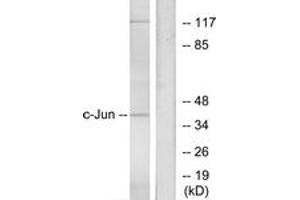 Western Blotting (WB) image for anti-Jun Proto-Oncogene (JUN) (AA 40-89) antibody (ABIN2888966) (C-JUN Antikörper  (AA 40-89))