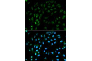 Immunofluorescence analysis of MCF7 cell using TFPI antibody. (TFPI Antikörper)