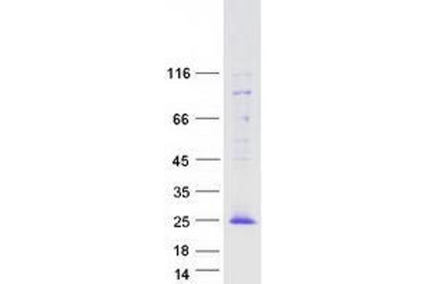 TOMM20L Protein (Myc-DYKDDDDK Tag)