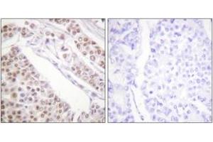 Immunohistochemistry (IHC) image for anti-Histone H2B (acLys12) antibody (ABIN2890727) (Histone H2B Antikörper  (acLys12))