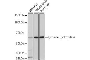 Western blot analysis of extracts of various cell lines, using Tyrosine Hydroxylase Rabbit mAb (ABIN1682210, ABIN3019364, ABIN3019365 and ABIN7101758) at 1:1000 dilution. (PNPT1 Antikörper)