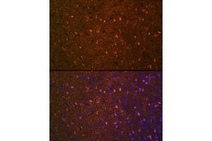 Immunofluorescence analysis of mouse brain using BDNF Rabbit mAb (ABIN7265916) at dilution of 1:100 (40x lens). (BDNF Antikörper)