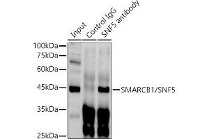 Immunoprecipitation analysis of 300 μg extracts of HeLa cells using 3 μg SM/SNF5 antibody . (SMARCB1 Antikörper  (AA 77-376))