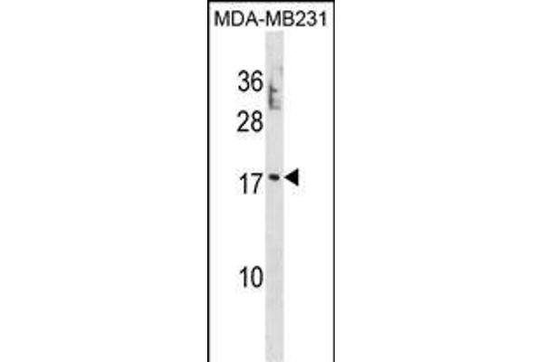 PTRH2 Antikörper  (N-Term)