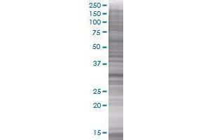 CENPH transfected lysate (CENPH 293T Cell Transient Overexpression Lysate(Denatured))