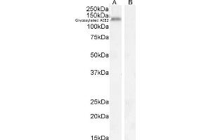 (ABIN7505817) (0. (ACE2 Antikörper  (C-Term))