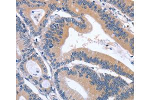 Immunohistochemistry (IHC) image for anti-Growth Differentiation Factor 11 (GDF11) antibody (ABIN2434352) (GDF11 Antikörper)