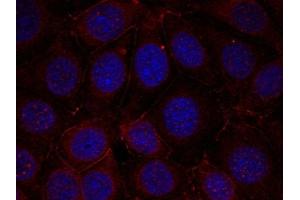 Immunofluorescence staining of methanol-fixed MCF cells using IGF-1R(Phospho-Tyr1165/Tyr1166) Antibody. (IGF1R Antikörper  (pTyr1165, pTyr1166))