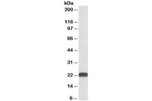 Western blot testing of human liver lysate with BLVRB antibody at 0. (BLVRB Antikörper)