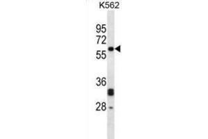 Western Blotting (WB) image for anti-N-Myristoyltransferase 2 (NMT2) antibody (ABIN2998073) (NMT2 Antikörper)