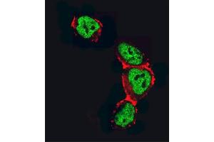 Confocal immunofluorescent analysis of HDAC2 Antibody (C-term) (ABIN6242378 and ABIN6577318) with 293 cell followed by Alexa Fluor 488-conjugated goat anti-rabbit lgG (green). (HDAC2 Antikörper  (C-Term))