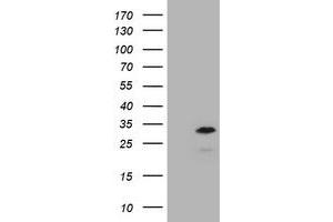 Image no. 1 for anti-Membrane-Spanning 4-Domains, Subfamily A, Member 1 (MS4A1) antibody (ABIN1497209) (CD20 Antikörper)